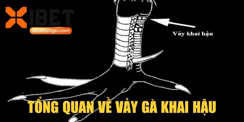 Tổng quan về vảy gà khai hậu
